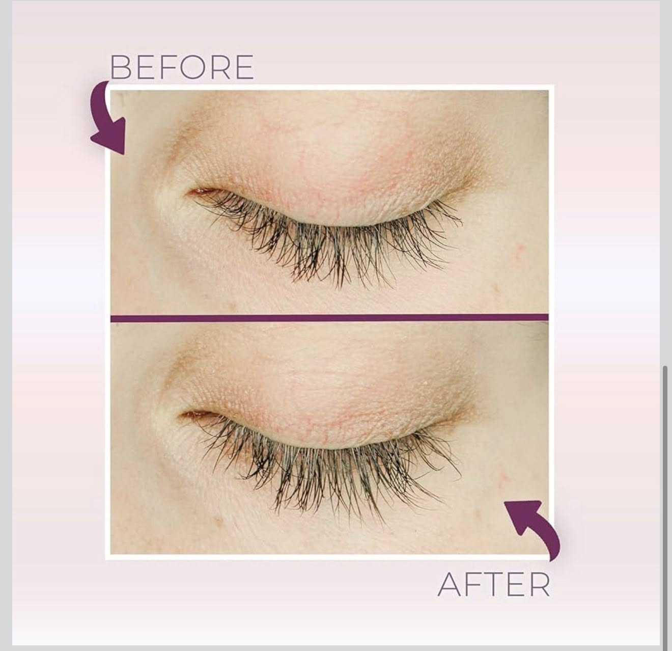Blinc Lash & Brow Enhancer Serum (4.50 ml / 0.15 fl oz)